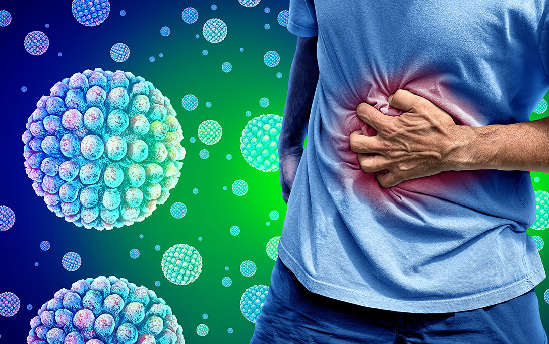 Διαχείριση του νοροϊού (Norovirus)